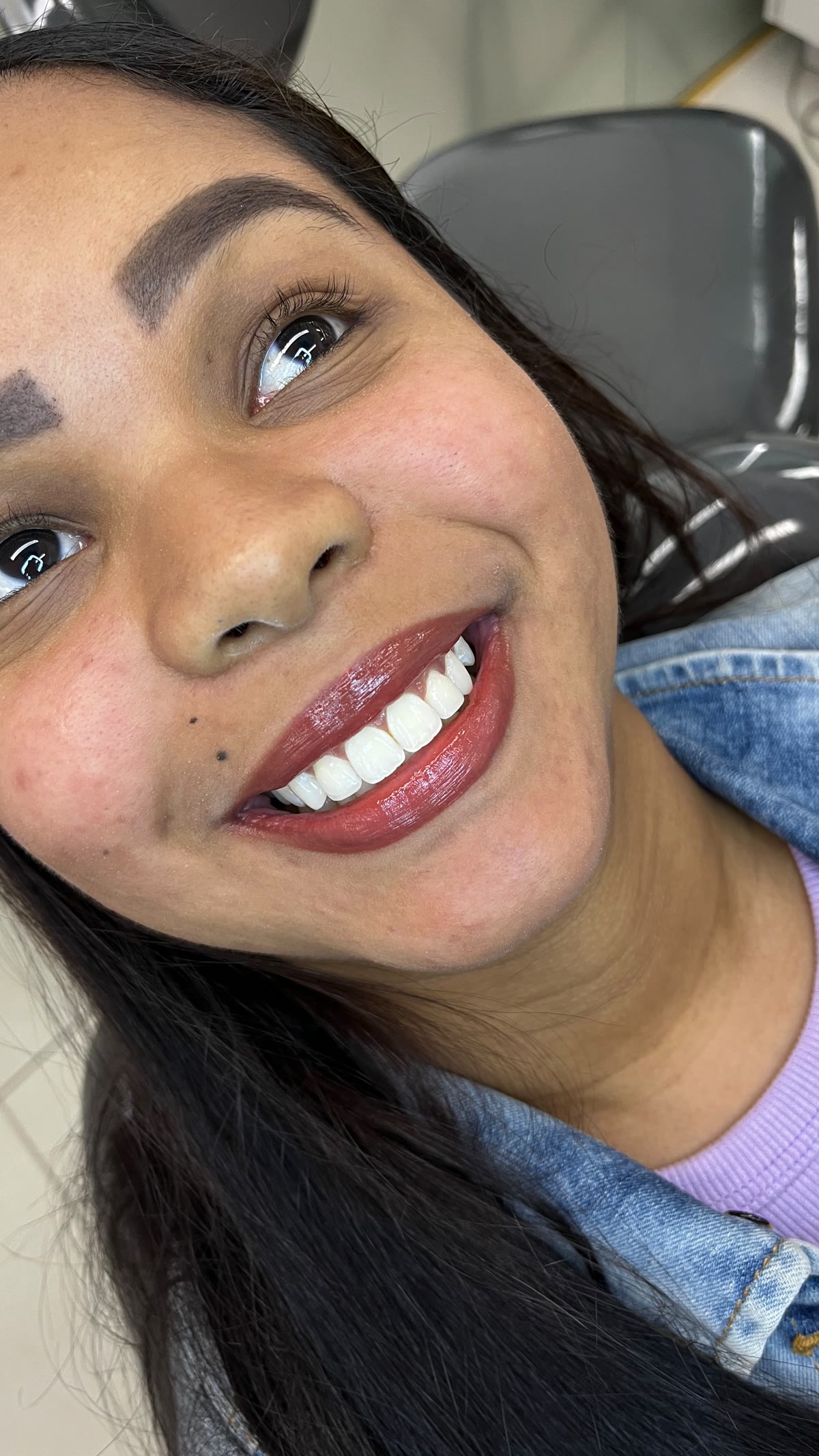 Sorriso de paciente após clareamento dental