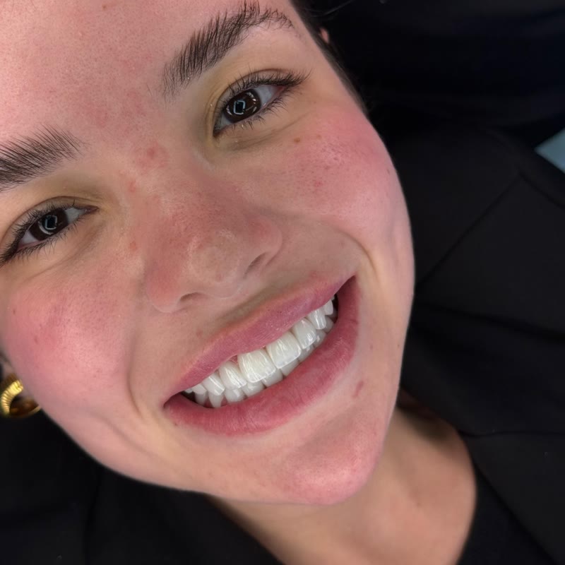 Paciente sorrindo após tratamento na clínica
